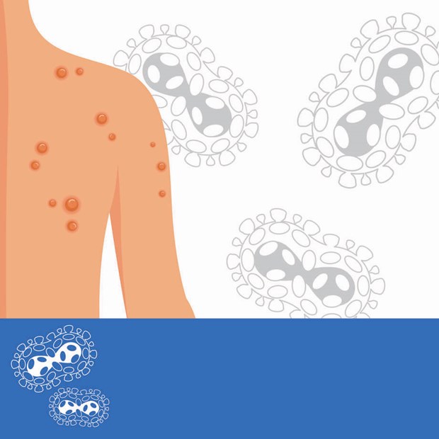 Nu erbjuds vaccinering mot apkoppor